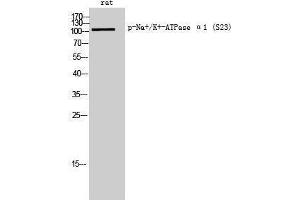 Western Blotting (WB) image for anti-Sodium Potassium ATPase, alpha1 (ATP1A1) (pSer23) antibody (ABIN3182451) (ATP1A1 抗体  (pSer23))