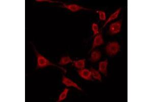 ABIN6275345 staining A549 by IF/ICC. (EHHADH 抗体  (Internal Region))