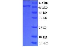 Colony Stimulating Factor 1 Receptor (CSF1R) (AA 20-514) protein (His tag) expressed in E.