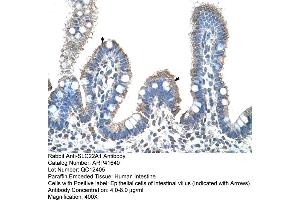 Rabbit Anti-SLC22A1 Antibody  Paraffin Embedded Tissue: Human Intestine Cellular Data: Epithelial cells of intestinal villas Antibody Concentration: 4. (SLC22A1 抗体  (C-Term))