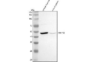 Western blot analysis of Mmp12 using anti-Mmp12 antibody (ABIN7600791).