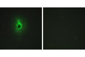 Peptide - +Immunohistochemistry analysis of paraffin-embedded human breast carcinoma tissue using Collagen VI α3 antibody. (COL6a3 抗体)