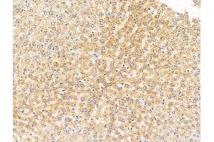 ABIN7094866 and ABIN7098918 at 1/100 staining Rat liver tissue by IHC-P. (SPRED2 抗体  (Internal Region))