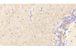 Detection of PMP22 in Mouse Cerebellum Tissue using Polyclonal Antibody to Peripheral Myelin Protein 22 (PMP22)
