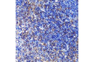 Immunohistochemistry of paraffin-embedded Rat spleen using SW Rabbit pAb (ABIN7270654) at dilution of 1:100 (40x lens). (SWAP70 抗体  (AA 316-585))