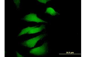 Immunofluorescence of monoclonal antibody to EDIL3 on HeLa cell. (EDIL3 抗体  (AA 101-199))