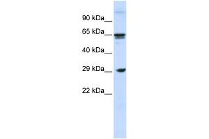 WB Suggested Anti-CLEC4M Antibody Titration:  0. (C-Type Lectin Domain Family 4, Member M (CLEC4M) (N-Term) 抗体)