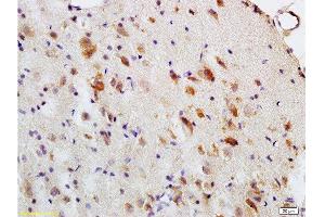 Formalin-fixed and paraffin embedded: rat brain tissue labeled with Anti-MBP Polyclonal Antibody , Unconjugated at 1:200, followed by conjugation to the secondary antibody and DAB staining (MBP 抗体  (AA 69-85))