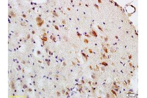 Formalin-fixed and paraffin embedded: rat brain tissue labeled with Anti-MBP Polyclonal Antibody , Unconjugated at 1:200, followed by conjugation to the secondary antibody and DAB staining (MBP 抗体  (AA 69-85))
