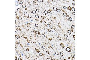 Immunohistochemistry of paraffin-embedded mouse brain using RPL17 Rabbit pAb (ABIN6128342, ABIN6147115, ABIN6147116 and ABIN6221632) at dilution of 1:100 (40x lens). (RPL17 抗体  (AA 1-184))