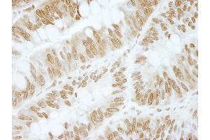Immunohistochemistry (IHC) image for anti-Zinc Finger and BTB Domain Containing 40 (ZBTB40) (AA 1140-1190) antibody (ABIN7448873) (ZBTB40 抗体  (AA 1140-1190))