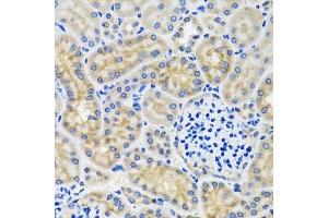Immunohistochemistry of paraffin-embedded mouse kidney using ANTXR2 antibody. (ANTXR2 抗体  (AA 339-488))