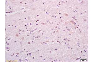 Formalin-fixed and paraffin embedded rat brain tissue labeled with Anti CKAP4 Polyclonal Antibody,Unconjugated (ABIN717506) at 1:200 followed by conjugation to the secondary antibody and DAB staining. (CKAP4 抗体  (AA 525-602))