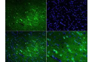 Formalin-fixed and paraffin embedded rat brain labeled with Rabbit Anti-Talin Polyclonal Antibody, FITC Conjugated at 1:200 for 60 minutes. (TLN1 抗体  (AA 1601-1750) (FITC))