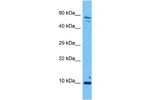 Host:  Rabbit  Target Name:  DBI  Sample Tissue:  Human Ovary Tumor  Antibody Dilution:  1ug/ml (Diazepam Binding Inhibitor 抗体  (N-Term))