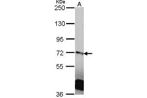 WB Image Sample (30 ug of whole cell lysate) A: A431 , 7. (RANGAP1 抗体  (N-Term))