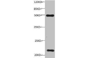 All lanes:Mouse anti-Human Timp1 monoclonal antibody at 1 μg/mL Lane 1: HepG-2 cell lysate Predicted band size : 23 kDa Observed band size : 23 kDa Additional bands at:50KD (TIMP1 抗体)