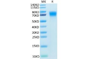 SDS-PAGE (SDS) image for Tumor Necrosis Factor Receptor Superfamily, Member 21 (TNFRSF21) (AA 42-349) protein (His tag) (ABIN7274499)