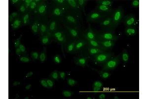 Immunofluorescence of monoclonal antibody to FAF1 on HeLa cell. (FAF1 抗体  (AA 551-650))