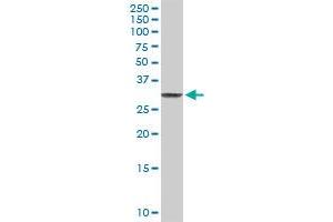 CLIC3 MaxPab rabbit polyclonal antibody. (CLIC3 抗体  (AA 1-236))