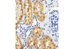 Immunohistochemical analysis of paraffin-embedded H. (ALT 抗体  (N-Term))