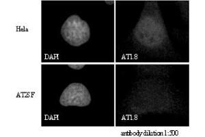 Image no. 5 for anti-Ataxia Telangiectasia Mutated (ATM) (C-Term) antibody (ABIN363380)