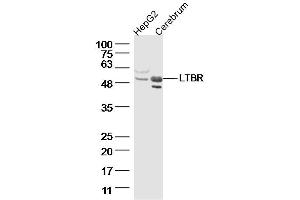 Lane 1: HepG2, Lane 2: Mouse cerebrum lysates probed with LTBR Polyclonal Antibody  at 1:300 overnight at 4˚C. (LTBR 抗体  (AA 351-435))