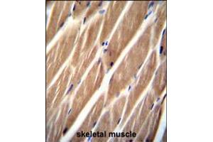 PIP5KL1 Antibody immunohistochemistry analysis in formalin fixed and paraffin embedded human skeletal muscle followed by peroxidase conjugation of the secondary antibody and DAB staining. (PIP5KL1 抗体  (N-Term))