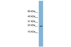 RPS13 antibody used at 1 ug/ml to detect target protein. (RPS13 抗体  (Middle Region))