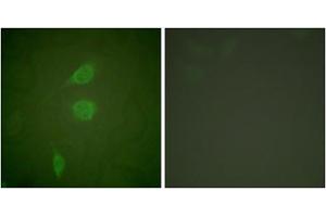 Immunofluorescence analysis of NIH/3T3 cells, using HDAC5 antibody (ABIN5976423). (HDAC5 抗体  (C-Term))