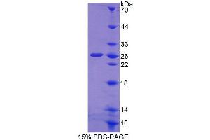 SDS-PAGE (SDS) image for Carnitine O-Octanoyltransferase (CROT) (AA 410-612) protein (His tag) (ABIN6238967)