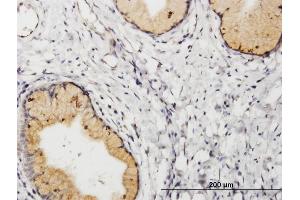 Immunoperoxidase of purified MaxPab antibody to PGF on formalin-fixed paraffin-embedded human uterine cervix. (PLGF 抗体  (AA 1-170))