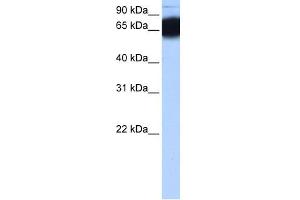 WB Suggested Anti-ZNF90 Antibody Titration: 0. (ZNF90 抗体  (N-Term))