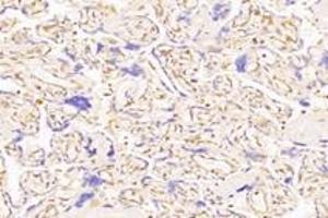 Immunohistochemistry (Paraffin-embedded Sections) (IHC (p)) image for anti-Prostaglandin F Receptor (FP) (PTGFR) antibody (ABIN7075209)