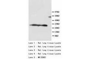 Image no. 1 for anti-Surfactant Protein A1 (SFTPA1) (AA 221-236) antibody (ABIN1493415) (Surfactant Protein A1 抗体  (AA 221-236))
