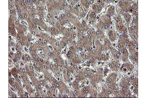 Immunohistochemical staining of paraffin-embedded Human liver tissue using anti-TBCC mouse monoclonal antibody. (TBCC 抗体)