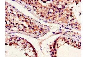 Immunohistochemistry of paraffin-embedded human testis tissue using ABIN7145318 at dilution of 1:100 (BCL2A1 抗体  (AA 1-175))