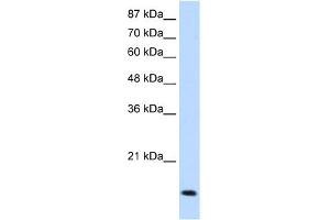 WB Suggested Anti-MYC Antibody Titration:  1. (c-MYC 抗体  (N-Term))