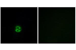 Immunofluorescence (IF) image for anti-Carbohydrate (N-Acetylglucosamine 6-O) Sulfotransferase 6 (CHST6) (C-Term) antibody (ABIN1850996) (CHST6 抗体  (C-Term))