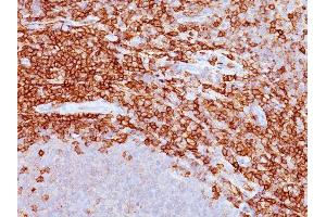 Formalin-fixed, paraffin-embedded human spleen stained with CD43 Mouse Monoclonal Antibody (DF-T1). (CD43 抗体)