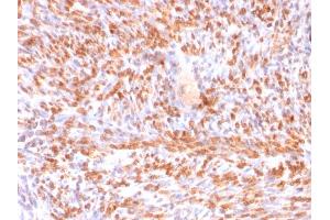 Formalin-fixed, paraffin-embedded human Uterus stained with Calponin-1 Recombinant Mouse Monoclonal Antibody (rCNN1/832). (Recombinant CNN1 抗体)
