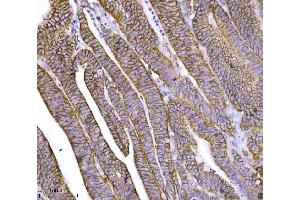 IHC analysis of CTNND1 using anti-CTNND1 antibody (ABIN7602220).