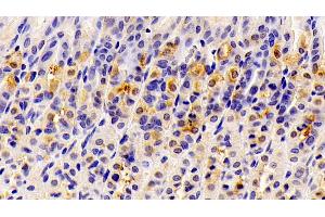 Immunohistochemistry (IHC) image for anti-3-Hydroxy-3-Methylglutaryl-CoA Synthase 2 (Mitochondrial) (HMGCS2) (AA 1-167) antibody (ABIN7445147)