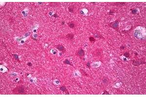 Anti-IRX3 antibody IHC staining of human brain, cortex neurons. (IRX3 抗体  (AA 271-320))