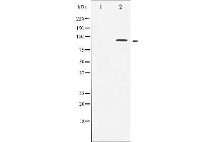Western Blotting (WB) image for anti-Neurotrophic Tyrosine Kinase, Receptor, Type 1 (NTRK1) (pTyr681), (Tyr680) antibody (ABIN6256787)
