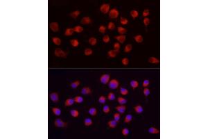 anti-Enolase 2 (Gamma, Neuronal) (ENO2) antibody