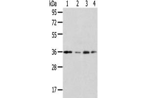 Western Blotting (WB) image for anti-Homeobox D13 (HOXD13) antibody (ABIN5961463) (Homeobox D13 抗体)