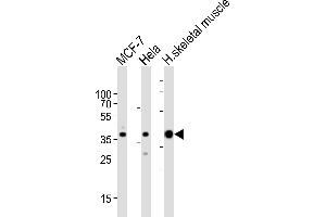 Western blot analysis of lysates from MCF-7, Hela cell line and human skeletal muscle tissue lysate (from left to right), using ALDOA Antibody (C-term) (ABIN389192 and ABIN2839355). (ALDOA 抗体  (C-Term))