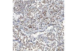 IHC analysis of U1-C/SNRPC using anti-U1-C/SNRPC antibody (ABIN7599016).