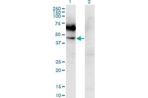 Western Blot analysis of CSF2RA expression in transfected 293T cell line by CSF2RA monoclonal antibody (M03), clone 2G5. (CSF2RA 抗体  (AA 1-400))